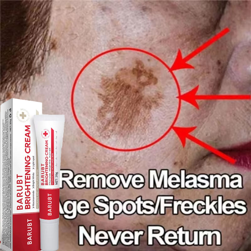 Powerful Spot-removing Whiteni - Korean Skincare Routine recensie en prijs