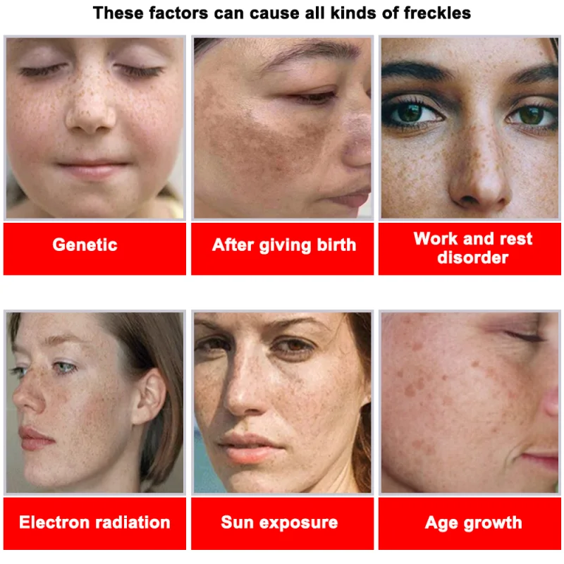 Powerful Spot-removing Whiteni - Korean Skincare Routine recensie en prijs